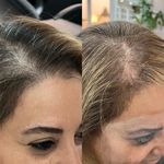 مرکز کراتین و احیا مو و پوست سر“صنم”