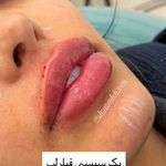 کلینیک زیبایی و لیزر دکتر آزاده اسماعیلی