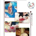 تیم تخصصی درمان زخم خانه سلامت