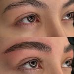 میکروبلیدینگ میناسلمانی