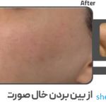 کلینیک زیبایی و لیزر الکس کندلا پارادایس