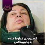 کلینیک زیبایی و لیزر الکس کندلا پارادایس
