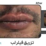 کلینیک زیبایی و لیزر الکس کندلا پارادایس