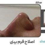 کلینیک زیبایی و لیزر الکس کندلا پارادایس