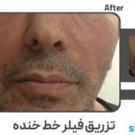 کلینیک زیبایی و لیزر الکس کندلا پارادایس