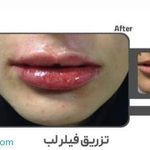 کلینیک زیبایی و لیزر الکس کندلا پارادایس