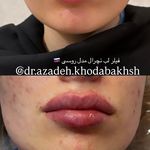 مطب زیبایی آرا