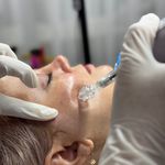 خدمات فیشال و اسکالپ سر آزی