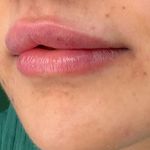 کلینیک پوست و لیزر دکتر مهتاب گلپایگانی