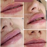 کلینیک زیبایی و لیزر مایا (دکتر وحیدی)
