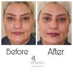 خدمات پوست ونوس