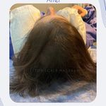 اولین مرکز میکرواسکالپ مشهد تاپ اسکالپ