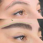 مرکز میکروبلیدینگ وفیبروز فرشته تقی زاده