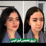 مرکز پوست و لیزر  سایناشور آمریکا دلدار