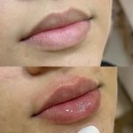 کلینیک پوست و مو و لیزر آتن