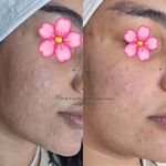 فیشال تخصصی معصومه قاسمی
