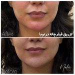 کلینیک زیبایی و لیزر مو زائد نوبا