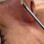 فیشال ‌پاکسازی پوست