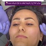 کلینیک لیزر و زیبایی دایان