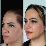 دکتر فرهاد محرابی سی سخت