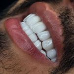 کلینیک‌دندانپزشکی دنتال آرنا-بیمه نیستیم