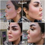 کلینیک زیبایی و لیزر مو گندم شرق تهران