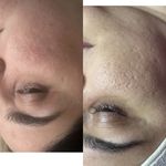 خدمات تخصصی فیشیال آیسو