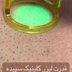 کلینیک لیزر و زیبایی سپیده