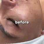 خدمات تخصصی  فیشیال مژگان