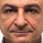 کلینیک زیبایی الماس کاملا اقساطی