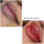 میکروبلیدینگ و ارایش دائم و شیدینگ لب