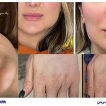 درمانگاه تخصصی پوست و مو اکسیر جوانی سایه