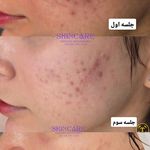 خدمات فیشال تخصصی هدیه جعفرزاده
