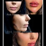 مرکزکلینیک لیزر زیبایی پوست و مو آسا