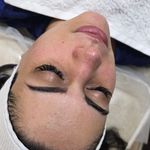 پاکسازی و جوانسازی پوست شقایق قربانی
