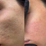 خدمات فیشال پاکسازی/اسکالپ اسکراپ ماهرخ