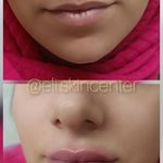 مطب زیبایی دکتر ملکی