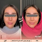 مرکز پزشکی و زیبایی میروژ سنتر