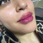 کلینیک لیزر و زیبایی مهسان