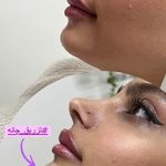 کلینیک لیزر و زیبایی مهسان