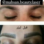 کلینیک لیزر و زیبایی مهسان