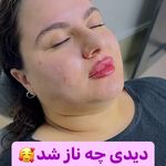 کلینیک لیزر و زیبایی مهسان