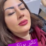 کلینیک لیزر و زیبایی مهسان
