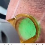کلینیک لیزر و زیبایی مهسان