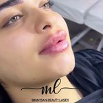 کلینیک لیزر و زیبایی مهسان