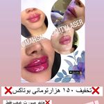 کلینیک لیزر و زیبایی مهسان