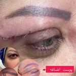 کلینیک لیزر و زیبایی مهسان