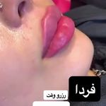 کلینیک لیزر و زیبایی مهسان