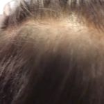 خدمات تخصصی پوست و مو لیلاک
