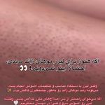 کلینیک لیزر و زیبایی مهسان